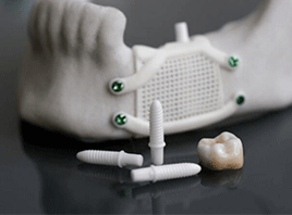 陶瓷3D打印为牙科领域带来新希望