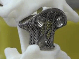 研究人员使用3D打印的生物材料制作面部骨移植术
