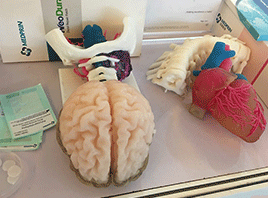 3D打印技术在神经外科应用及发展前景