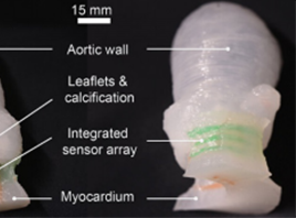 科学家3D打印出逼真的心脏瓣膜模型