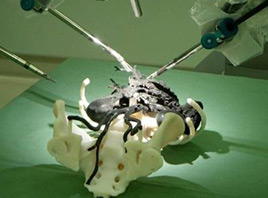 科学家开发了3D打印个性化陶瓷骨植入物的新方法